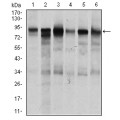 anti-HYAL1 antibody (Hyaluronidase-1) (N-Term)