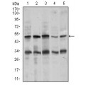 anti-HYAL1 antibody (Hyaluronidase-1) (N-Term)