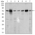 anti-HYAL1 antibody (Hyaluronidase-1) (N-Term)