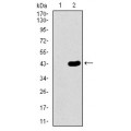 anti-HYAL1 antibody (Hyaluronidase-1) (N-Term)