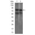 anti-HYAL1 antibody (Hyaluronidase-1) (N-Term)