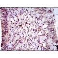 anti-HYAL1 antibody (Hyaluronidase-1) (N-Term)