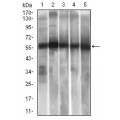 anti-HYAL1 antibody (Hyaluronidase-1) (N-Term)