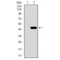 anti-HYAL1 antibody (Hyaluronidase-1) (N-Term)