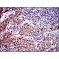 anti-HYAL1 antibody (Hyaluronidase-1) (N-Term)