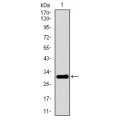 anti-HYAL1 antibody (Hyaluronidase-1) (N-Term)