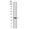 anti-HYAL1 antibody (Hyaluronidase-1) (N-Term)