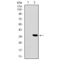 anti-HYAL1 antibody (Hyaluronidase-1) (N-Term)