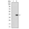 anti-HYAL1 antibody (Hyaluronidase-1) (N-Term)