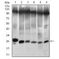 anti-HYAL1 antibody (Hyaluronidase-1) (N-Term)