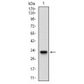 anti-HYAL1 antibody (Hyaluronidase-1) (N-Term)