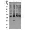 anti-HYAL1 antibody (Hyaluronidase-1) (N-Term)