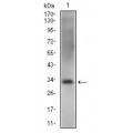 anti-HYAL1 antibody (Hyaluronidase-1) (N-Term)