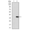 anti-HYAL1 antibody (Hyaluronidase-1) (N-Term)