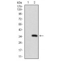 anti-HYAL1 antibody (Hyaluronidase-1) (N-Term)