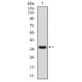 anti-HYAL1 antibody (Hyaluronidase-1) (N-Term)