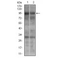 anti-HYAL1 antibody (Hyaluronidase-1) (N-Term)