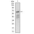 anti-HYAL1 antibody (Hyaluronidase-1) (N-Term)