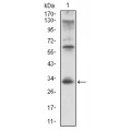 anti-HYAL1 antibody (Hyaluronidase-1) (N-Term)