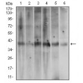 anti-HYAL1 antibody (Hyaluronidase-1) (N-Term)