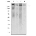 anti-HYAL1 antibody (Hyaluronidase-1) (N-Term)