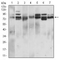 anti-HYAL1 antibody (Hyaluronidase-1) (N-Term)