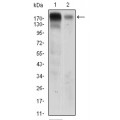 anti-HYAL1 antibody (Hyaluronidase-1) (N-Term)