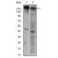 anti-HYAL1 antibody (Hyaluronidase-1) (N-Term)