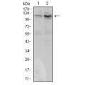 anti-HYAL1 antibody (Hyaluronidase-1) (N-Term)