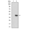 anti-HYAL1 antibody (Hyaluronidase-1) (N-Term)