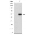 anti-HYAL1 antibody (Hyaluronidase-1) (N-Term)