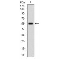 anti-HYAL1 antibody (Hyaluronidase-1) (N-Term)