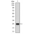 anti-HYAL1 antibody (Hyaluronidase-1) (N-Term)