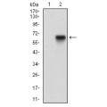 anti-HYAL1 antibody (Hyaluronidase-1) (N-Term)