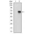 anti-HYAL1 antibody (Hyaluronidase-1) (N-Term)