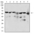 anti-HYAL1 antibody (Hyaluronidase-1) (N-Term)