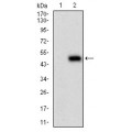anti-HYAL1 antibody (Hyaluronidase-1) (N-Term)