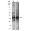anti-HYAL1 antibody (Hyaluronidase-1) (N-Term)