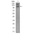 anti-HYAL1 antibody (Hyaluronidase-1) (N-Term)