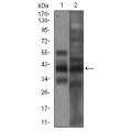 anti-HYAL1 antibody (Hyaluronidase-1) (N-Term)