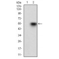 anti-HYAL1 antibody (Hyaluronidase-1) (N-Term)