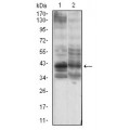 anti-HYAL1 antibody (Hyaluronidase-1) (N-Term)