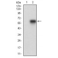 anti-HYAL1 antibody (Hyaluronidase-1) (N-Term)