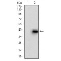 anti-HYAL1 antibody (Hyaluronidase-1) (N-Term)