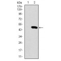 anti-HYAL1 antibody (Hyaluronidase-1) (N-Term)