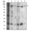 anti-HYAL1 antibody (Hyaluronidase-1) (N-Term)