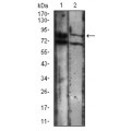 anti-HYAL1 antibody (Hyaluronidase-1) (N-Term)