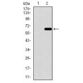 anti-HYAL1 antibody (Hyaluronidase-1) (N-Term)