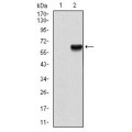 anti-HYAL1 antibody (Hyaluronidase-1) (N-Term)