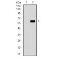 anti-HYAL1 antibody (Hyaluronidase-1) (N-Term)